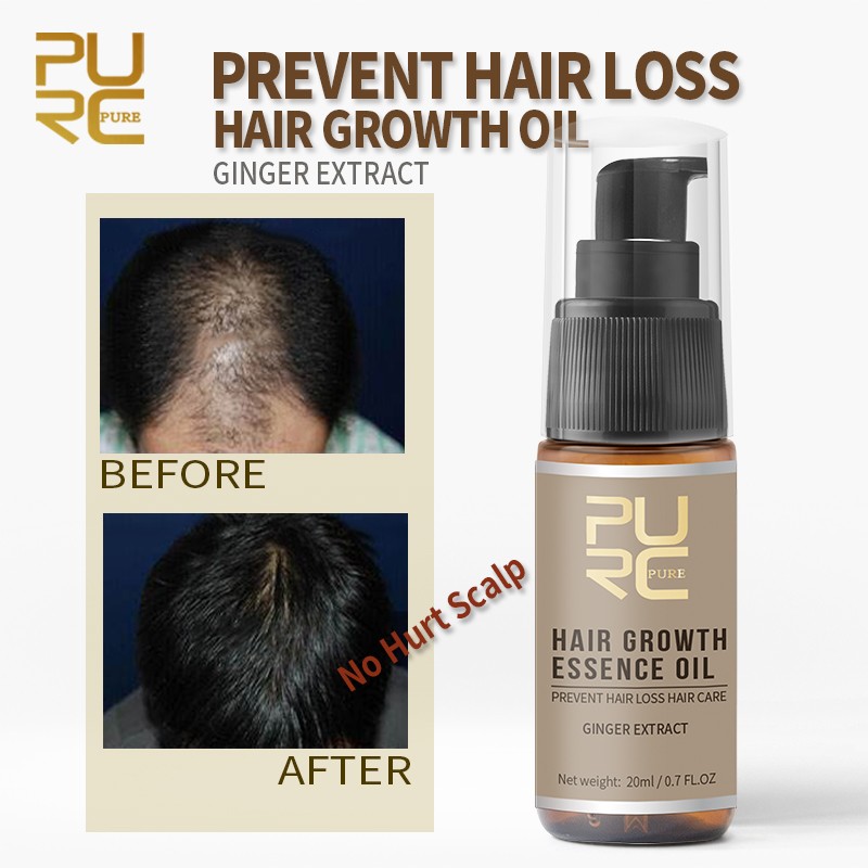 PURE Ginger Hair Shampoo + Oil for Anti Fall Hair Treatment - EasyShop